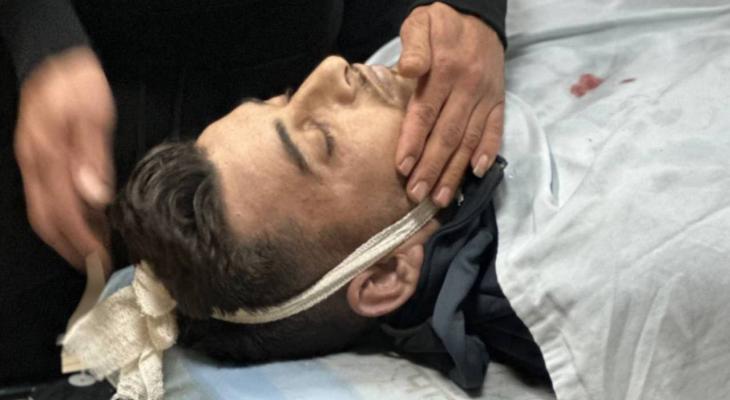 استشهاد شاب برصاص الاحتلال في طمون جنوب طوباس
